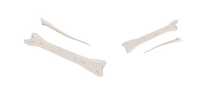 Sharp bones with bigger bones